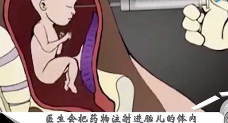 试管婴儿必须经历哪些过程？