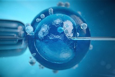 上海供卵机构包成功-通过III期试管婴儿囊胚技术，染色体罗氏的患者可以达到80%以上的成功率。