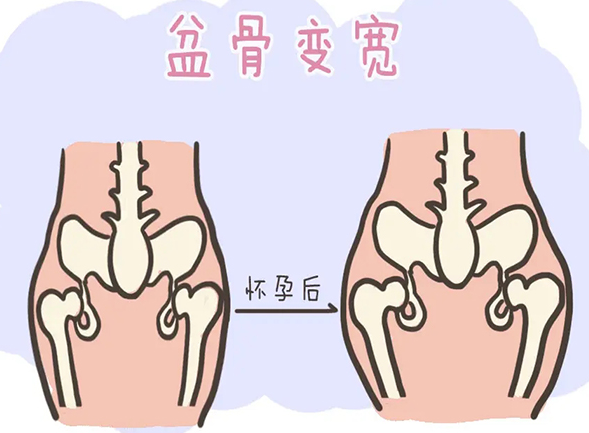 武汉42岁助孕机构：在此了解产后修复骨盆底是否有意义